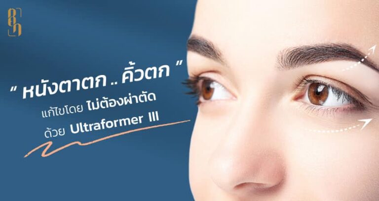 แก้ปัญหาหนังตาตก คิ้วตก โดยไม่ต้องผ่าตัด