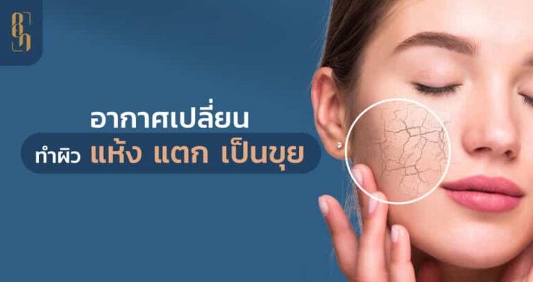 ปัญหาผิวแห้ง แตก เป็นขุย จากสภาพอากาศเปลี่ยน