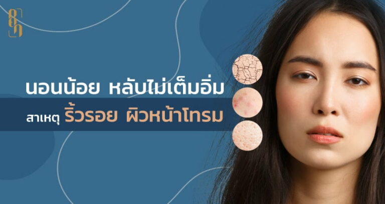 วิธีกู้ “ผิวหน้าโทรม” สำหรับคนนอนน้อย