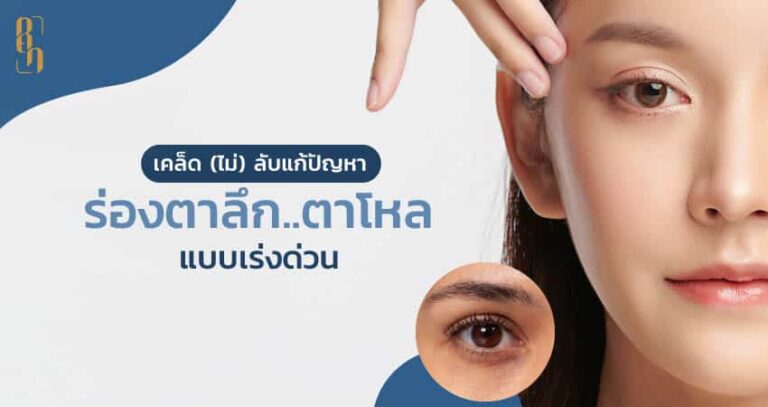 เคล็ด (ไม่) ลับแก้ปัญหา ร่องตาลึก ตาโหล แบบเร่งด่วน