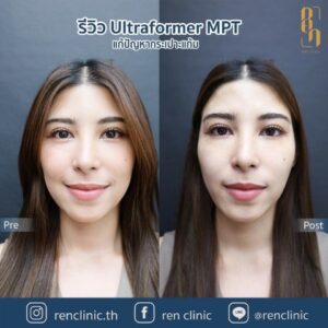 ren-ultraformermpt-review (3)