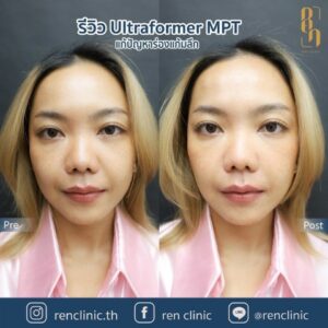 ren-ultraformermpt-review (5)