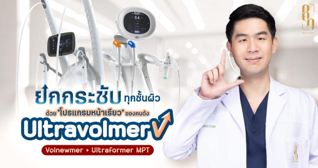 Ultravolmer V