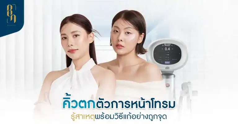 brow-ptosis คิ้วตก