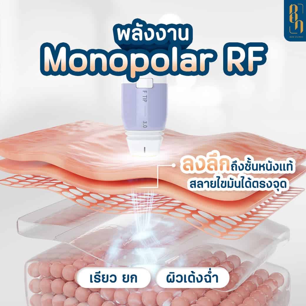 หน้าหย่อนคล้อย แก้ยังไง