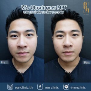 ren-ultraformermpt-review (2)