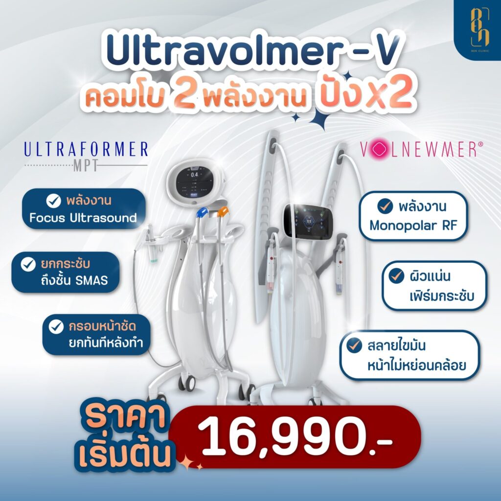 Ultravolmer V