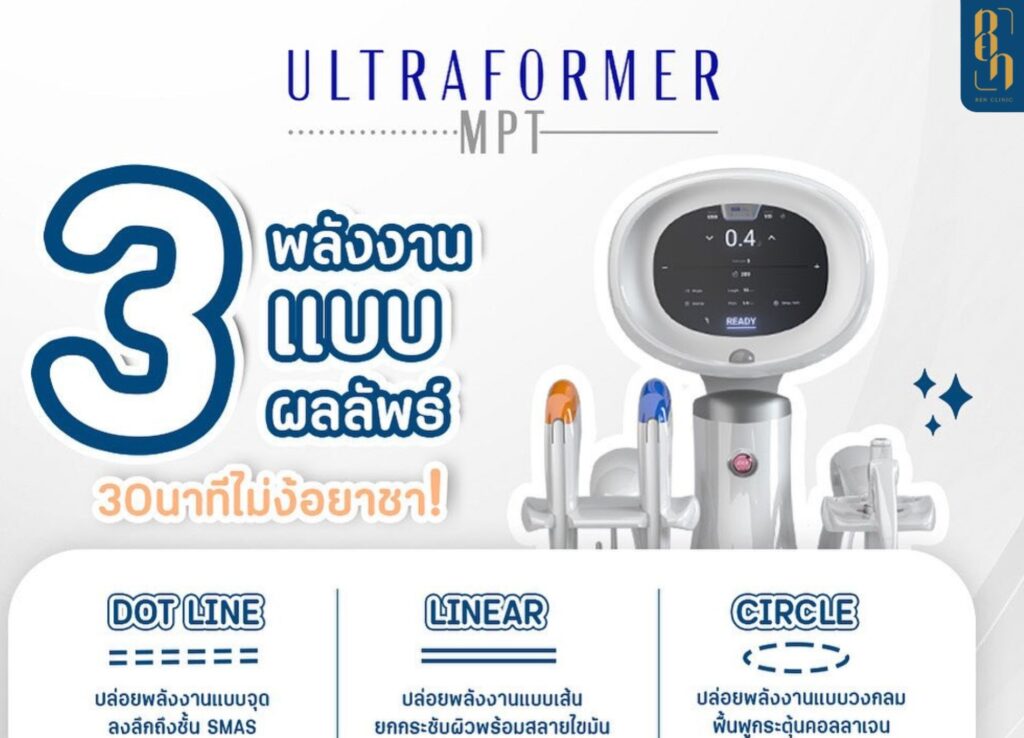 Ultravolmer V