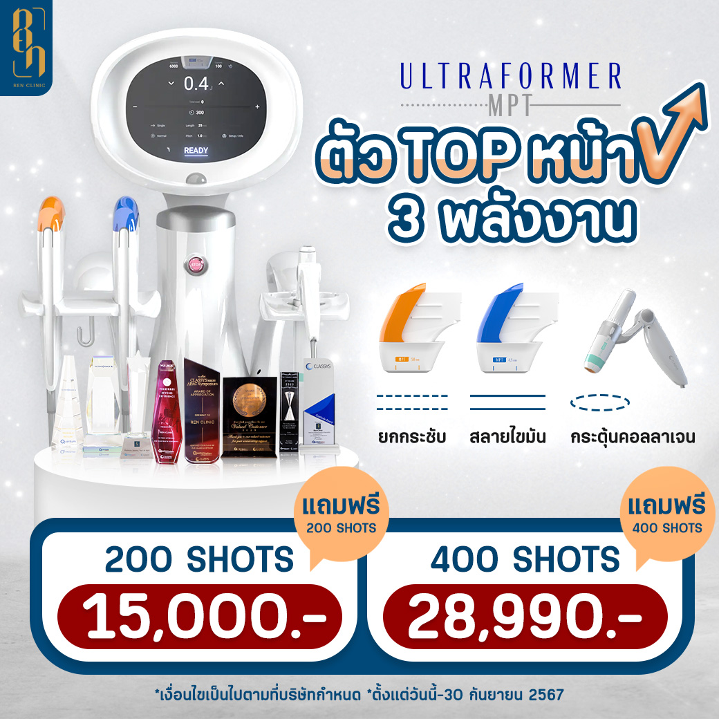 10SQ_SEPT_ตัวท้อปหน้าวี