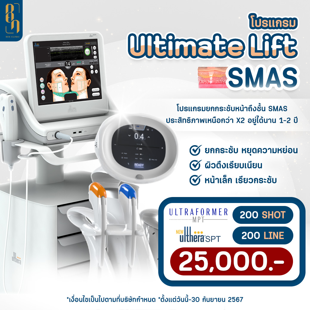 9SQ_SEPT_SMAS25000