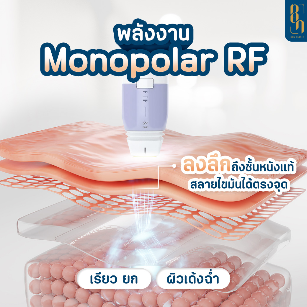 485694506_1041369618010831_5410264002197568729_n
