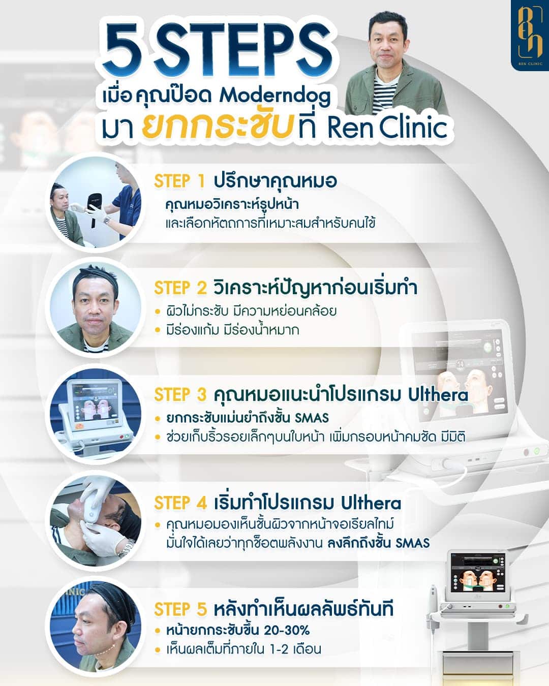 ก่อนทำ Ulthera SPT