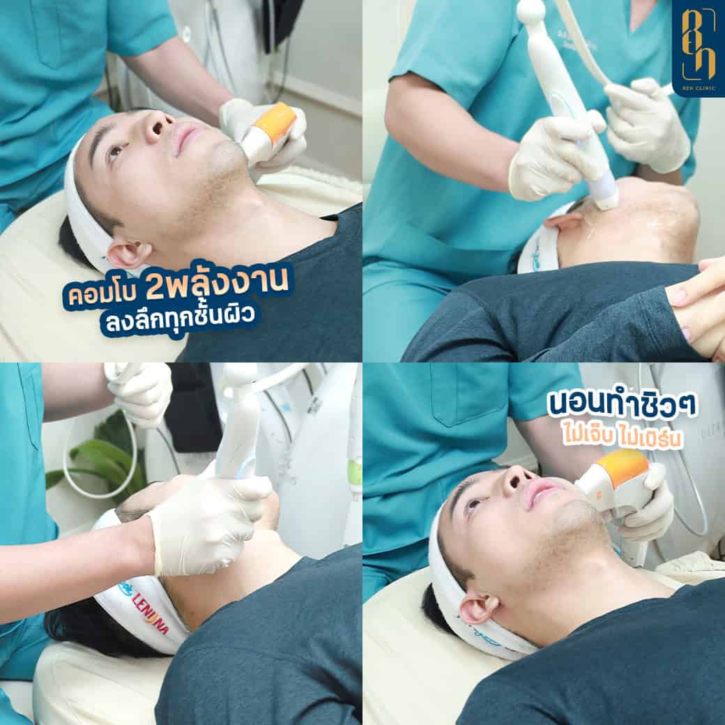 Ultraformer MPT กี่ช็อต