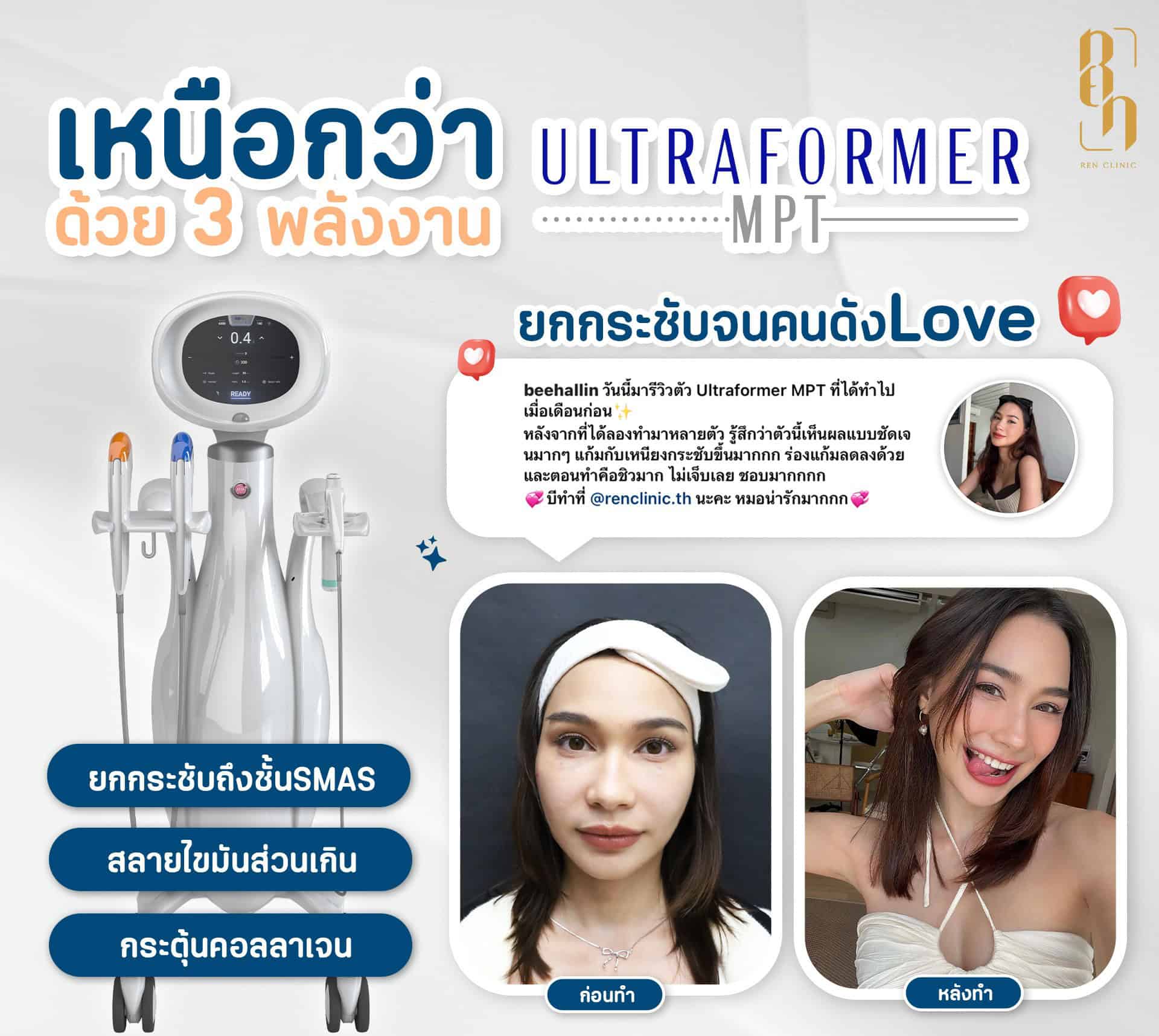 วิธีเลือกคลินิกทำ Ultraformer MPT
