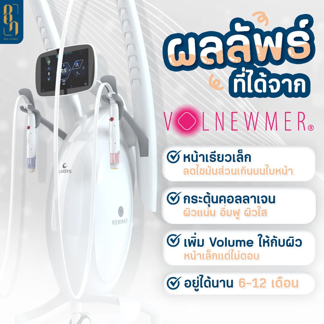 ผลลัพธ์ของ Volnewmer