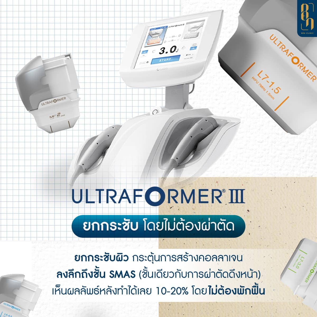 Ultraformer III คืออะไร รู้จักก่อนทำยกกระชับ