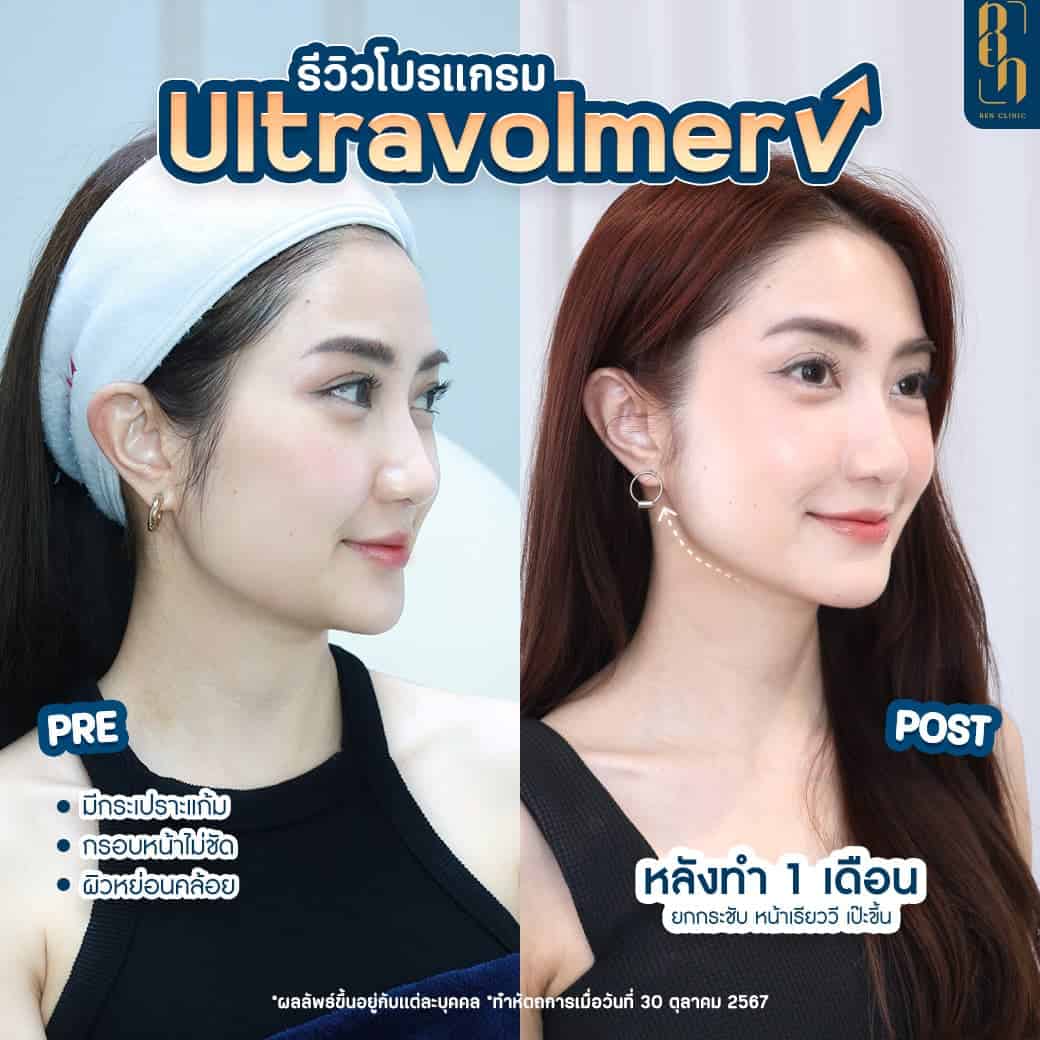 ปัญหาหน้าบาน