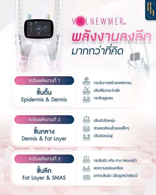 เครื่อง RF สลายไขมัน