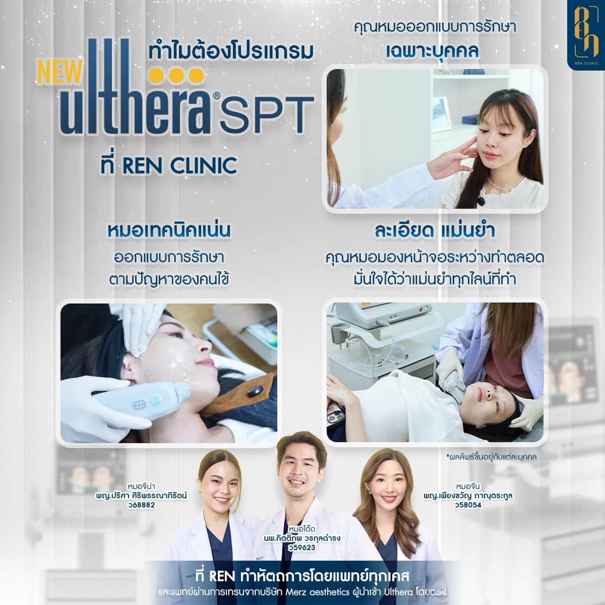 Ultherapy HIFU
