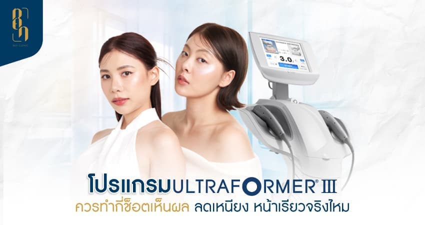Ultraformer III ควรทํากี่ช็อต
