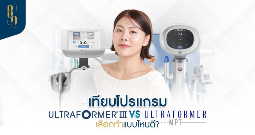 Ultraformer III VS. MPT