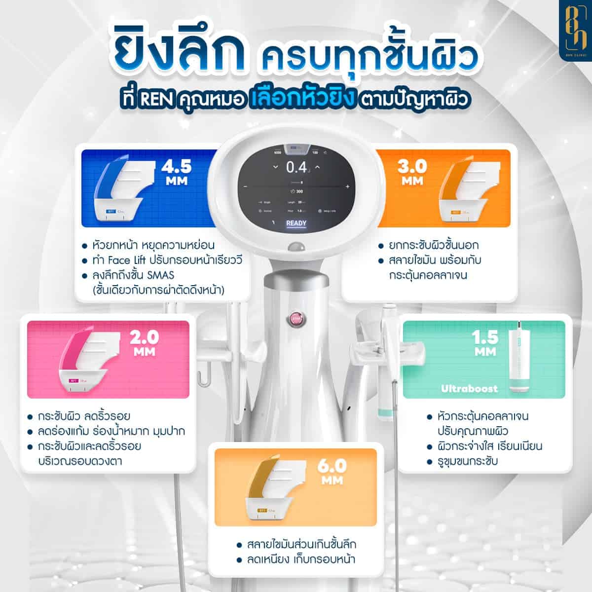 hifu คืออะไร