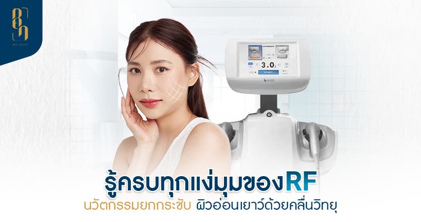 RF คืออะไร