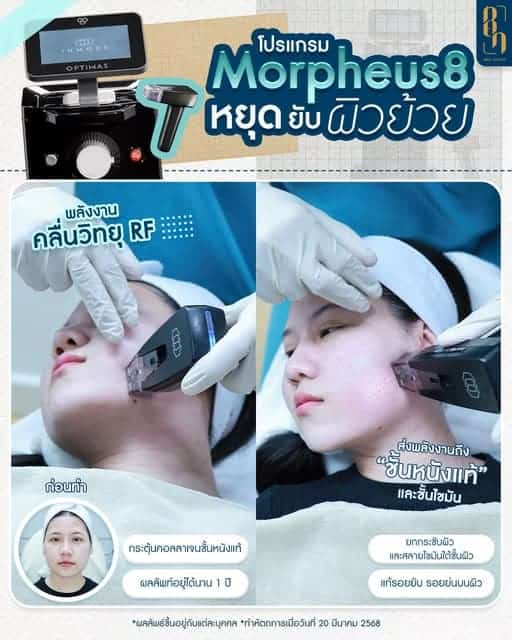 โปรแกรม Morpheus8