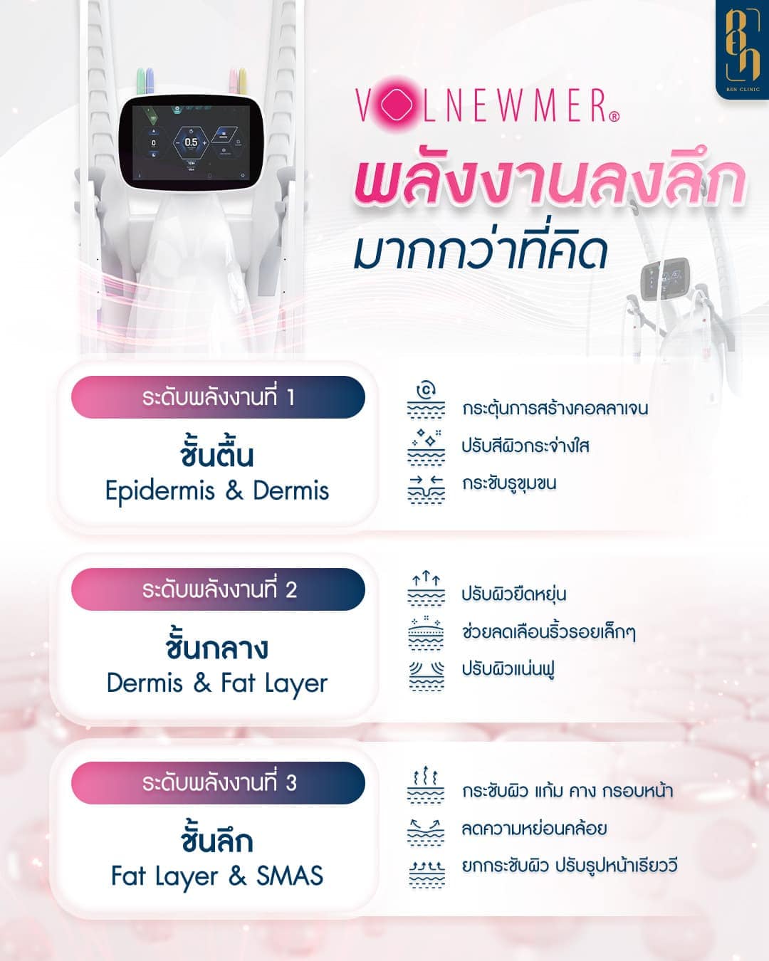 โปรแกรม Volnewmer