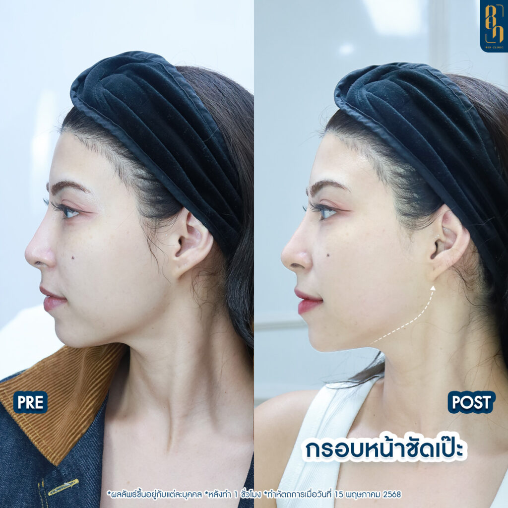 509430620_1111020124379113_3970835320053678113_n