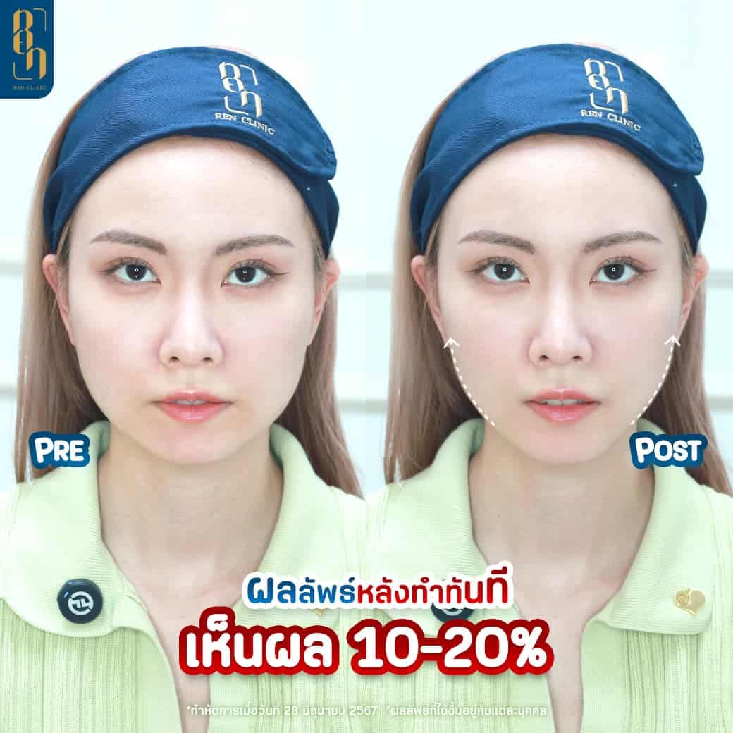 ไฮฟู่ รีวิว