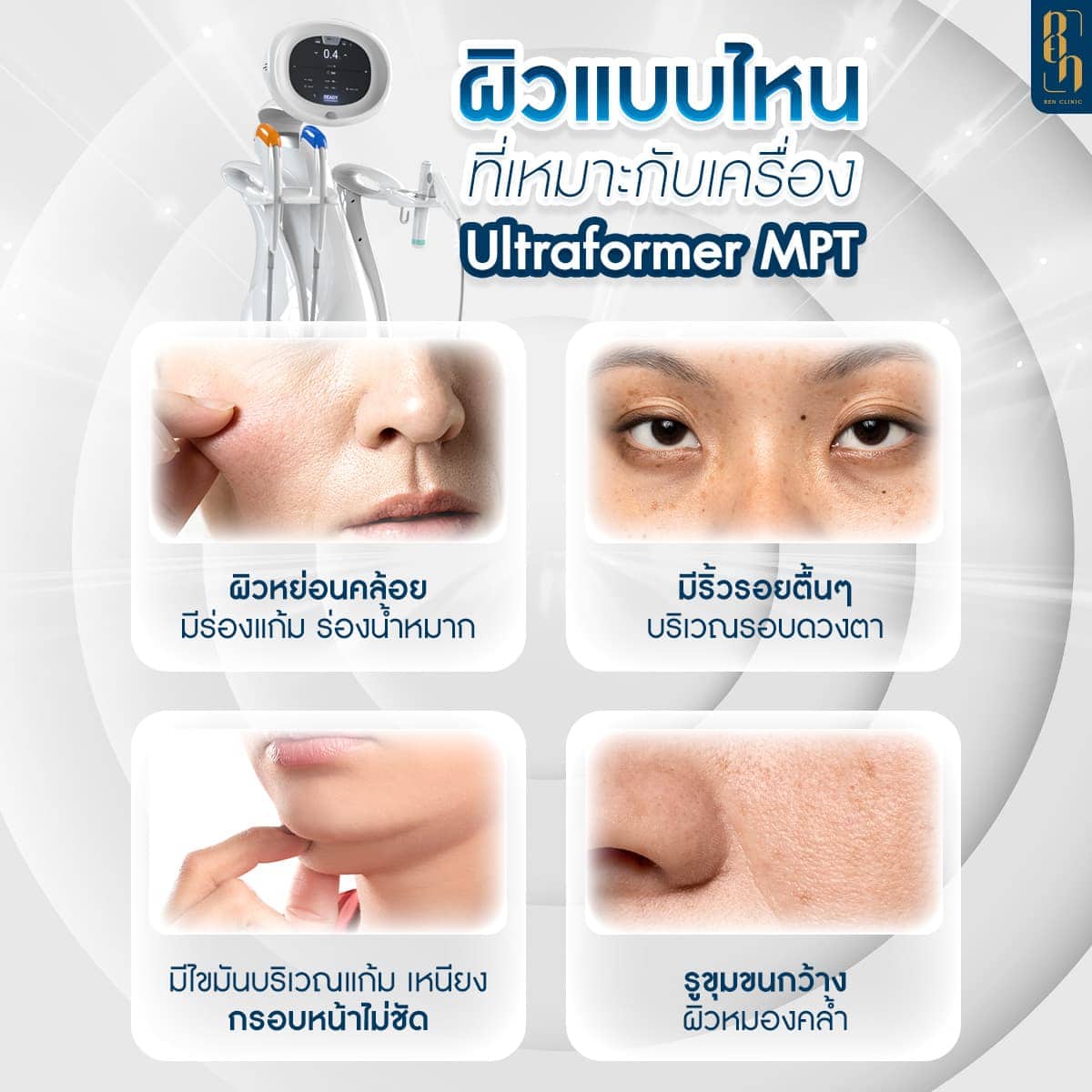 ทำ HIFU โปรแกรม Ultrafotmer MPT อยู่ได้นานไหม
