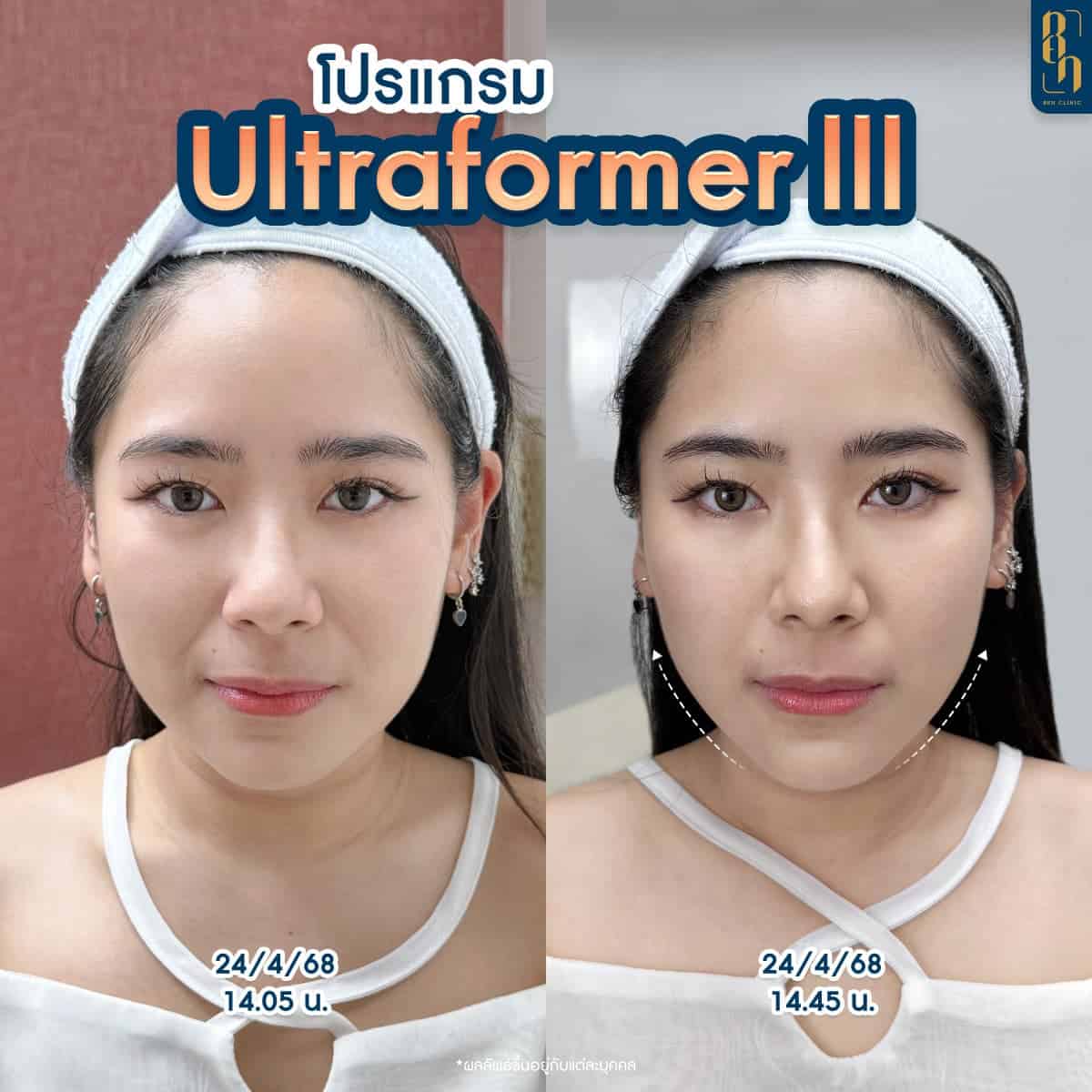 รีวิว ไฮฟู่