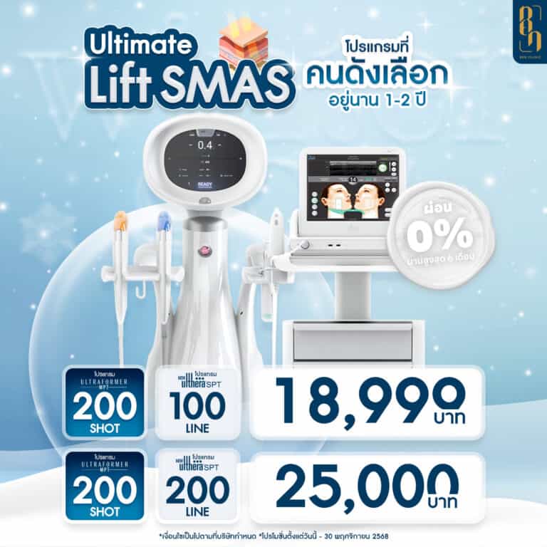 SQ_NOVPRO2025_Liftsmas