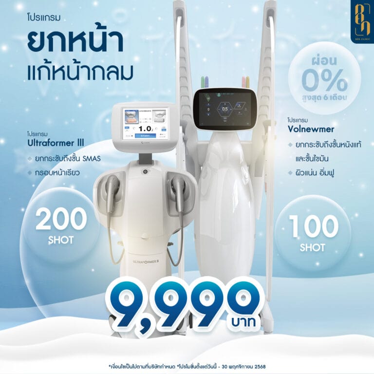 SQ_NOVPRO2025_โปรยกหน้ากลม