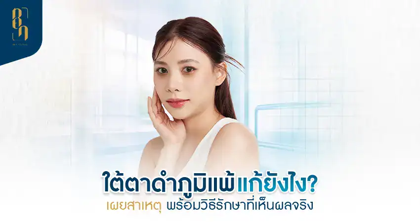 ใต้ตาดําภูมิแพ้ แก้ยังไง