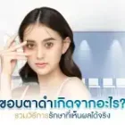 ขอบตาดำ เกิดจากอะไร? รวมวิธีการรักษาที่เห็นผลได้จริง