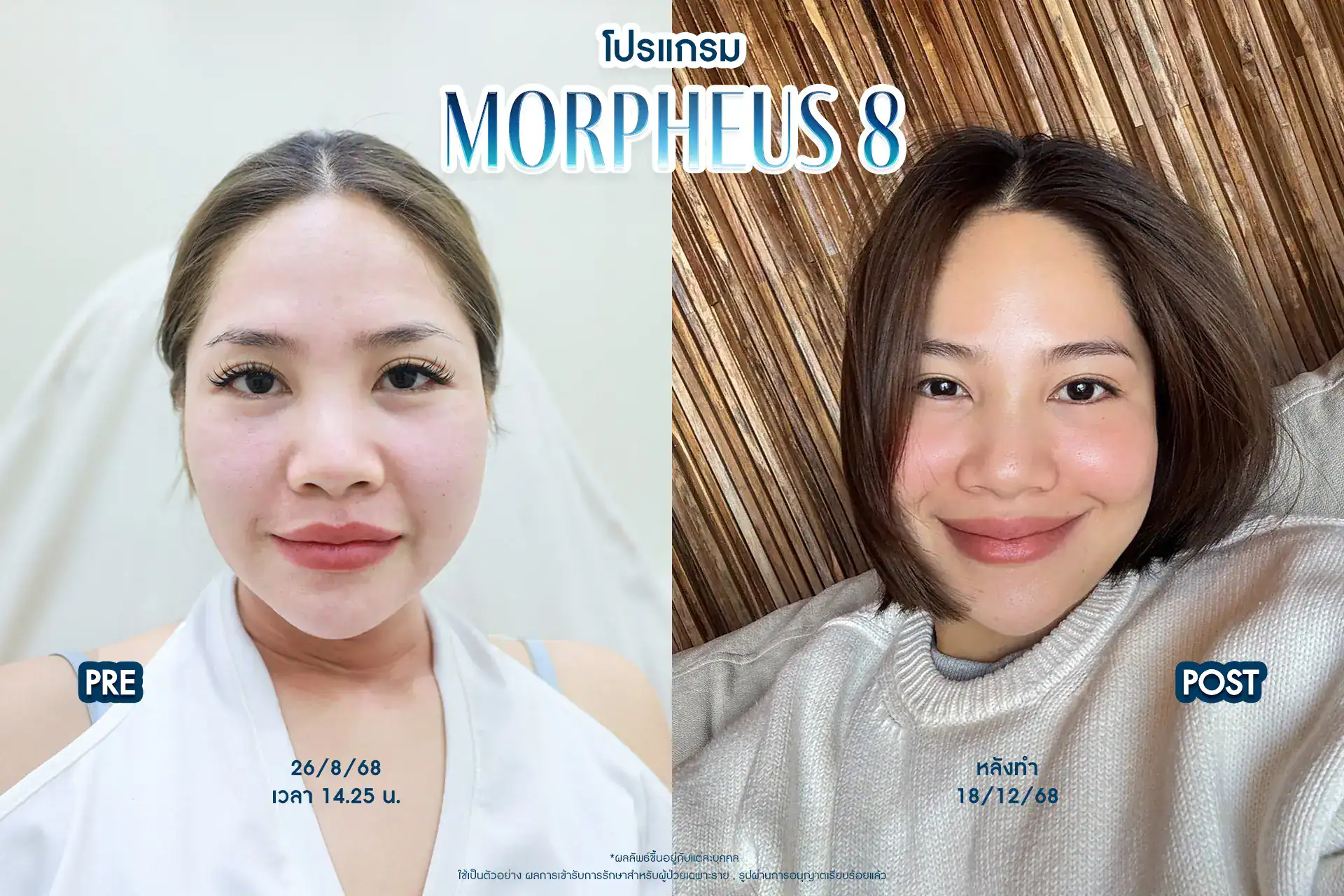 โปรแกรม Morpheus8