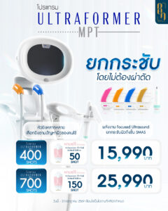 IG-โปร-04 (1)