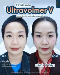 489957842_1057847799696346_5034207588642181180_n