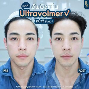 492415030_1064986338982492_8302476752606413811_n