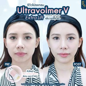 495343975_1078533324294460_576774841815451150_n